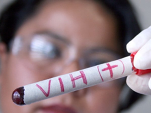 Audio: Veracruzanas con VIH entre la muerte, la omisión y la discriminación